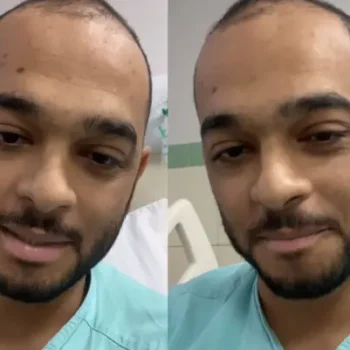 Cantor sertanejo Eduardo volta para a UTI e permanece sedado durante tratamento contra leucemia