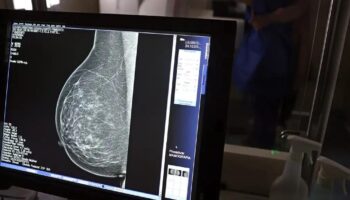 Planos de saúde terão de cobrir mamografia digital sem limite de idade