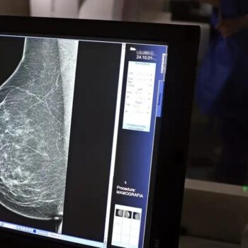 Planos de saúde terão de cobrir mamografia digital sem limite de idade