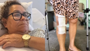 Médico é investigado após implantar prótese no joelho errado de idosa de 72 anos no Paraná